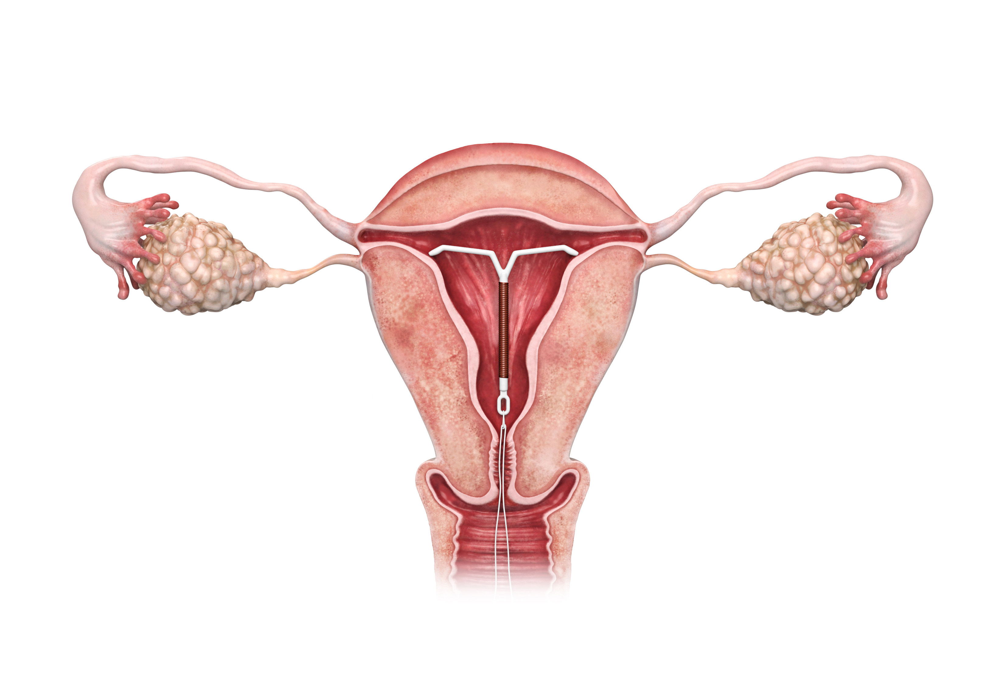 uterus graphic