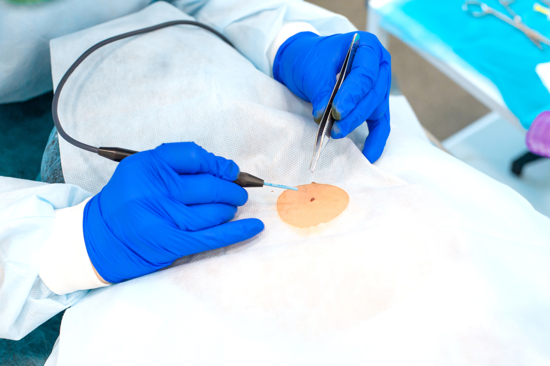 surgeon working on a patients skin